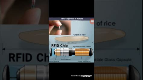 iuic says take the rfid chip on youtube|On Emerging Technology: What to Know When Your Patient Has .